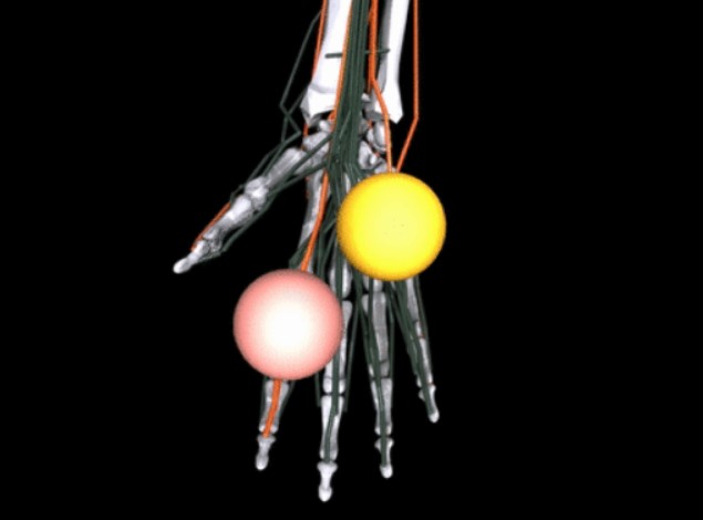 Meta's AI will help doctors develop better prosthetics