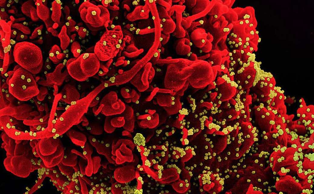 COVID-19 was third leading cause of death in the United States in both 2020 and 2021