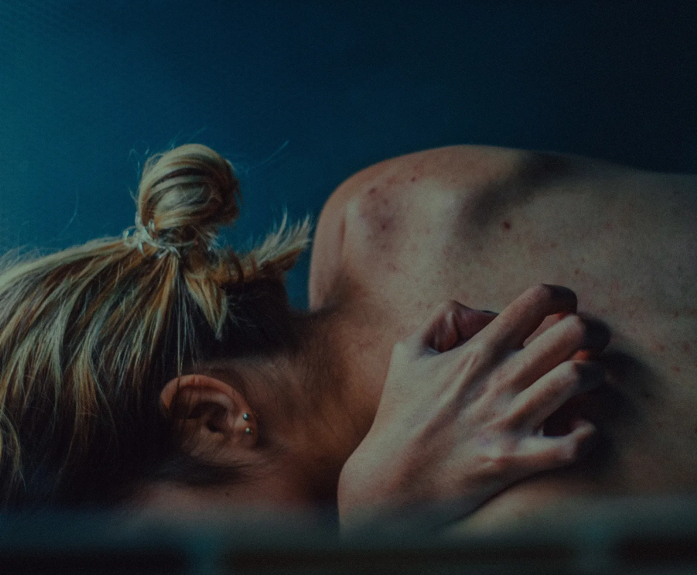 How to Safely Care For Your Skin During and After Monkeypox