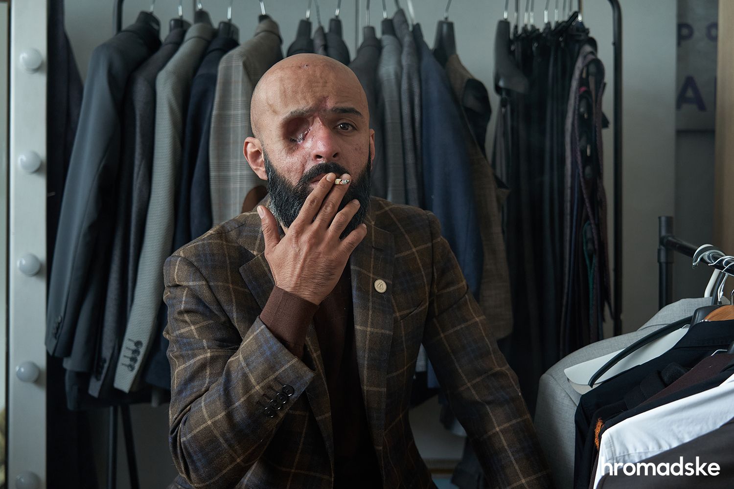 Losing an eye, an arm or a leg is a small death. The story of