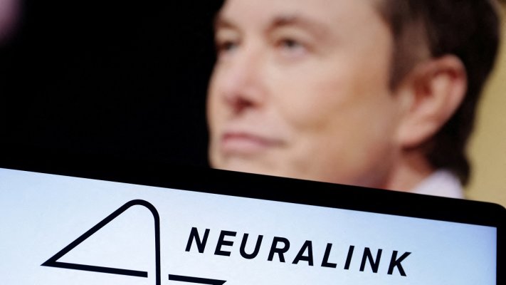 Elon Musk’s company Neuralink implanted a chip in the human brain for the first time