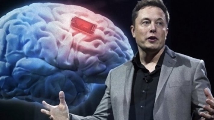 Neuralink Telepathy chip: what it is and how it works