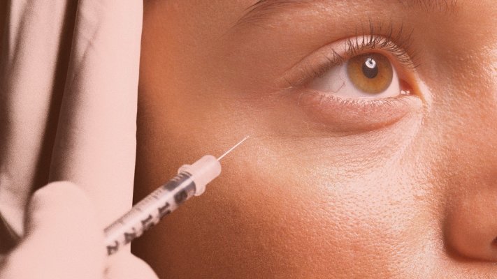 My Botox Doesn’t Work Like It Used To